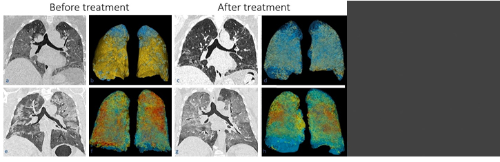 Aging And Disease