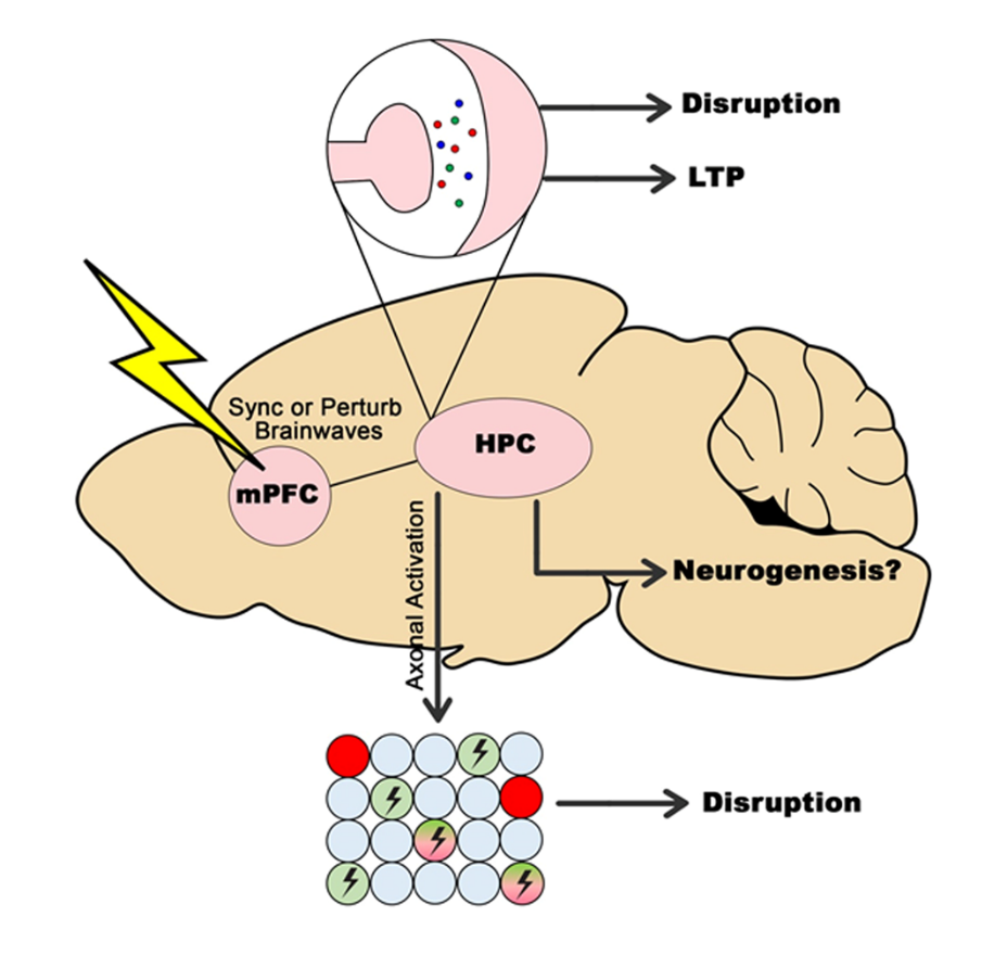 The Paradoxical Effect of Deep Brain Stimulation on Memory