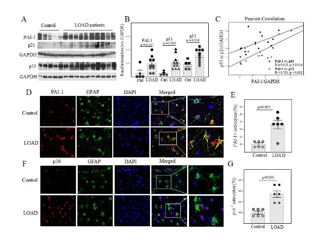 Aging, Plasminogen Activator Inhibitor 1, Brain Cell Senescence 