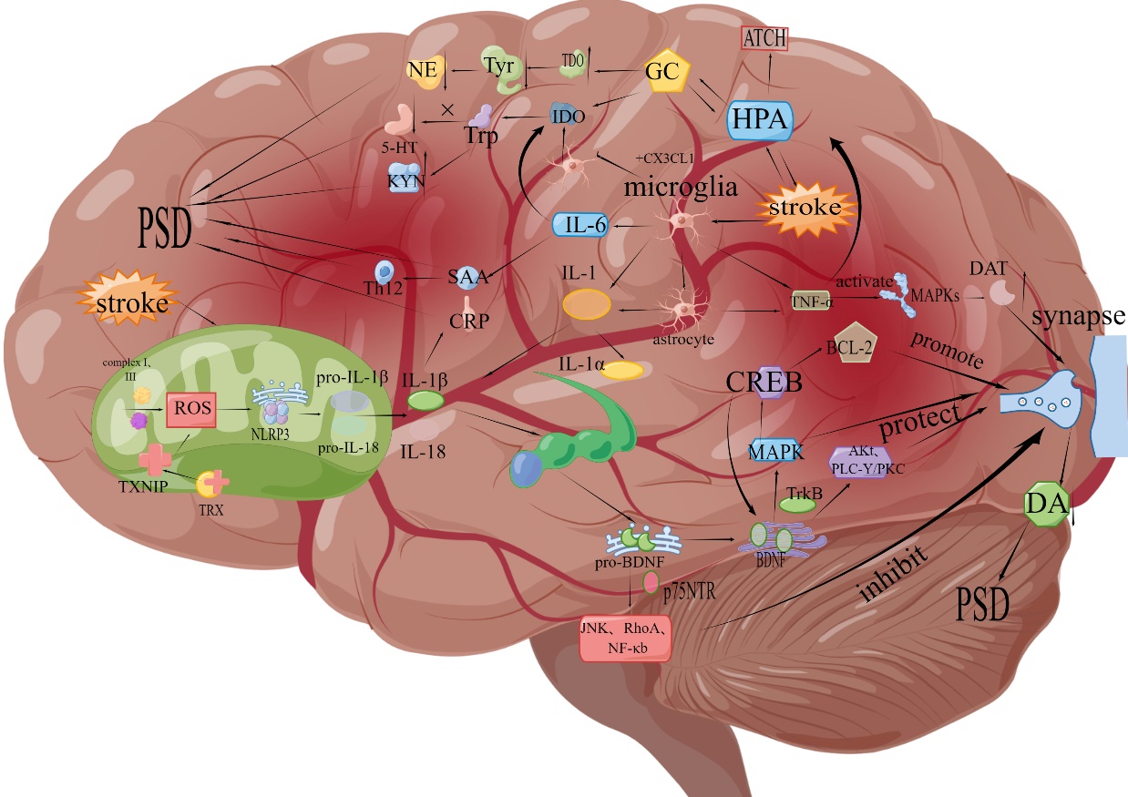 Inflammatory Pathogenesis of Post-stroke Depression