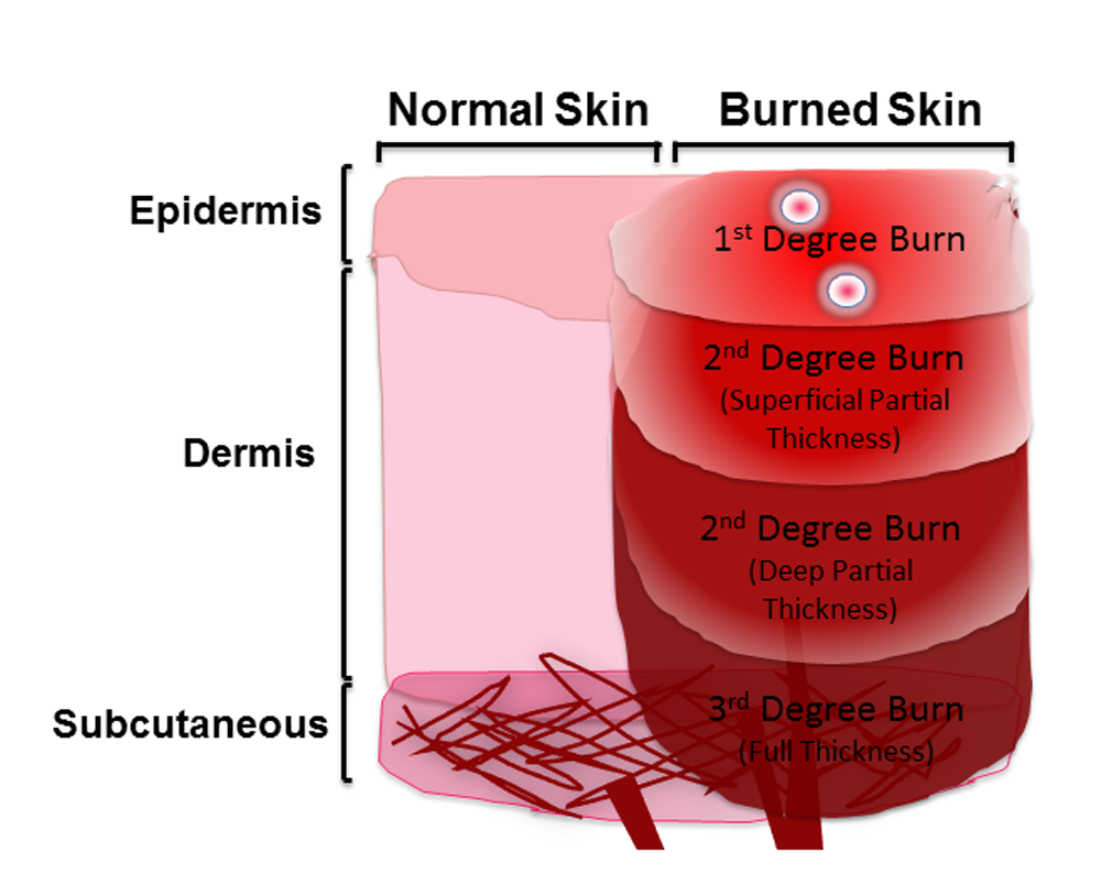 Burn all перевод